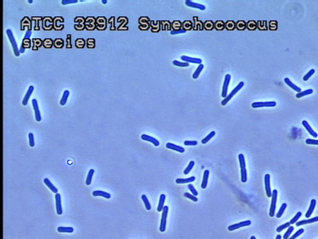 Micrograph of Cells at 1000X ATCC 33912
