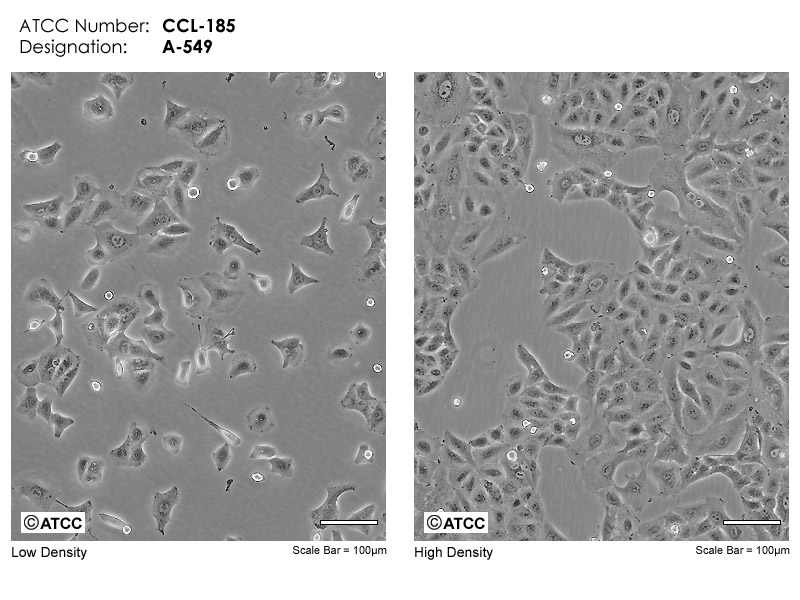 A549 ATCC CCL-185 Cell Micrograph
