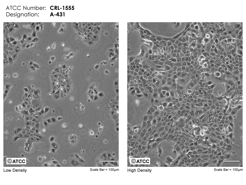 Cell Micrograph A-431 ATCC CRL-1551 cells