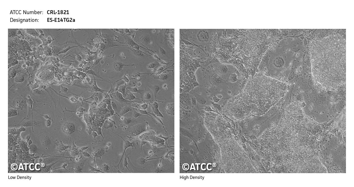 cell micrograph of ATCC CRL-1821