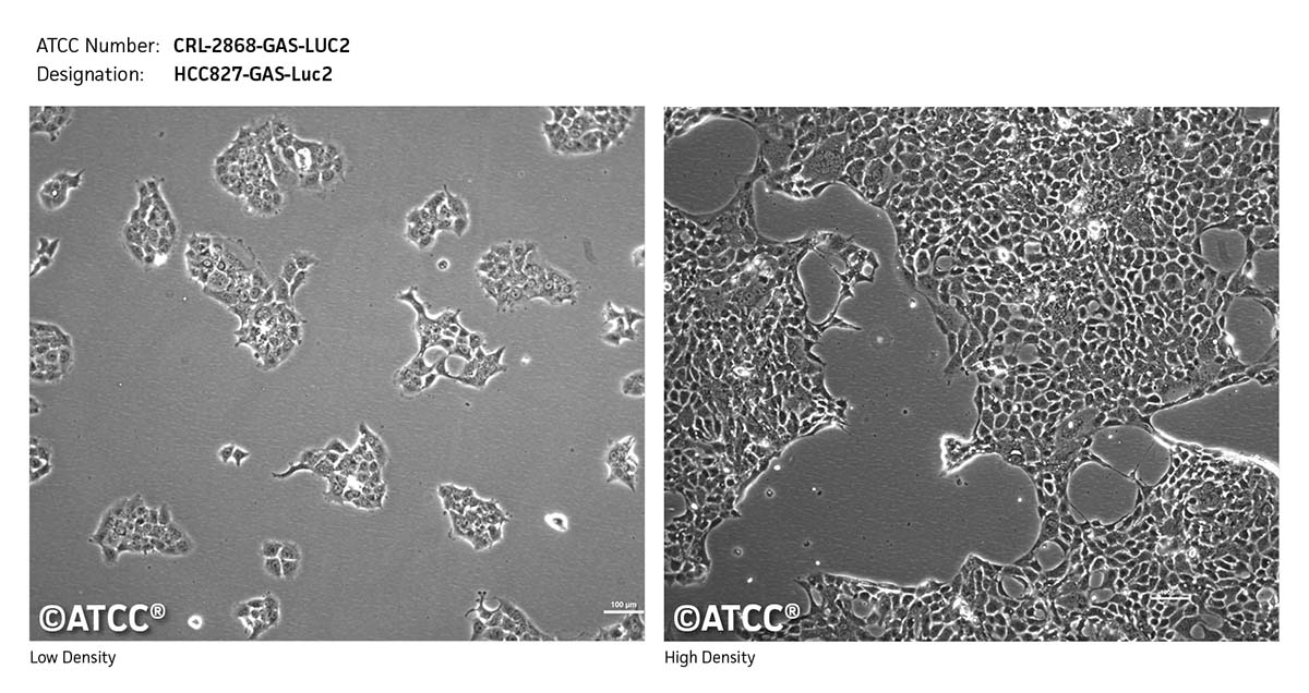 Cell micrograph CRL-2868-GAS-LUC2