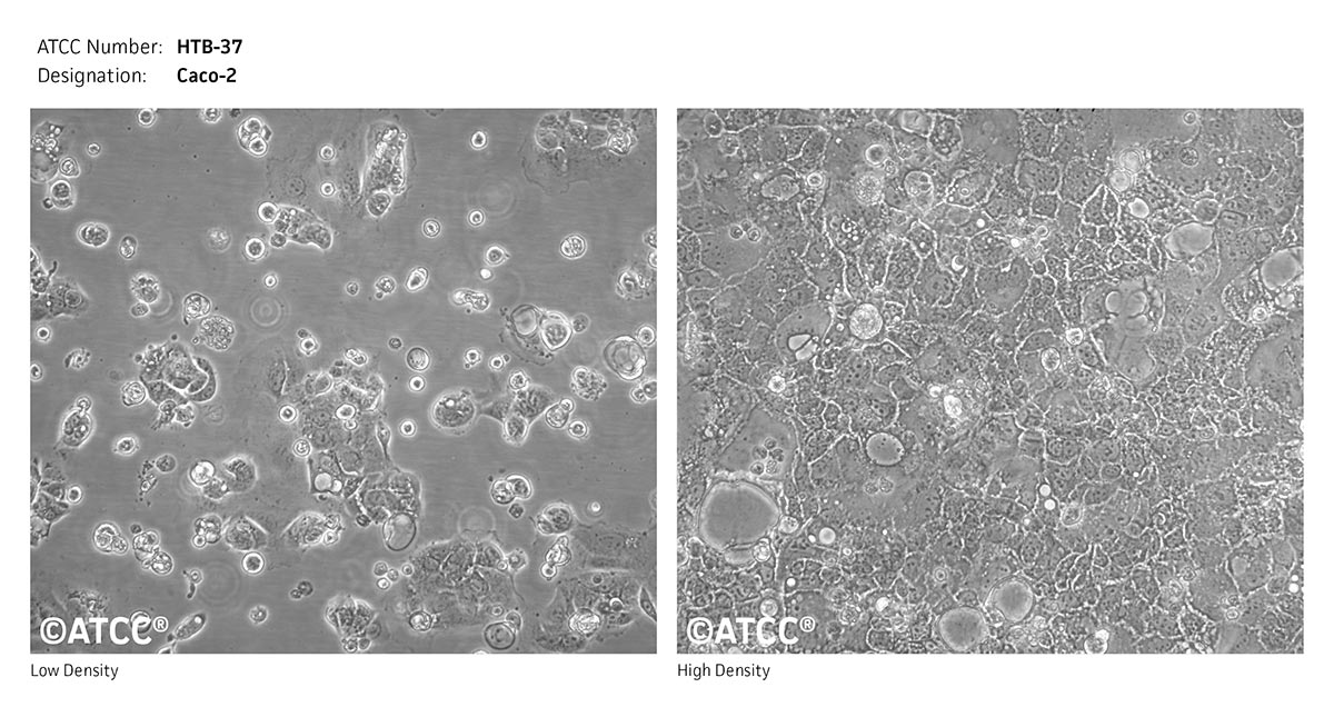 Cell Micrograph of ATCC HTB-37, Caco-2 cells